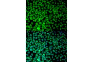 Immunofluorescence analysis of MCF-7 cells using RBX1 antibody. (RBX1 anticorps)