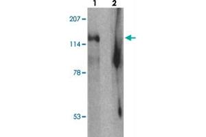 Western blot analysis of SGSM2 in human cerebellum tissue with SGSM2 polyclonal antibody  at 1 ug/mL in (1) the absence and (2) the presence of blocking peptide. (SGSM2 anticorps  (Internal Region))
