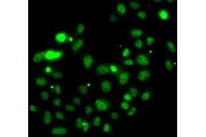 Immunofluorescence analysis of U2OS cells using PMS2 Polyclonal Antibody (PMS2 anticorps)