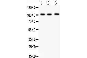 Anti- ITCH Picoband antibody, Western blotting All lanes: Anti ITCH  at 0.