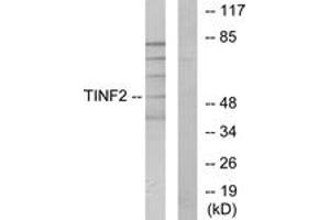 Western blot analysis of extracts from HuvEc cells, using TINF2 Antibody. (TINF2 anticorps  (AA 71-120))