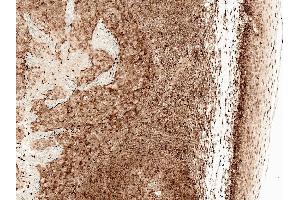 Immunohistochemistry analysis using Rabbit Anti-CCR2 Polyclonal Antibody (ABIN5066696).