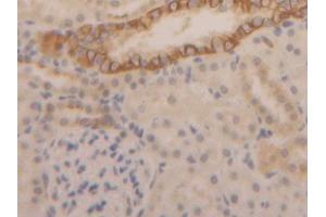DAB staining on IHC-P; Samples: Rat Kidney Tissue (Cytokeratin 1 anticorps  (AA 350-488))