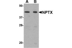 Western Blotting (WB) image for anti-Neuronal Pentraxin II (NPTX2) (Middle Region) antibody (ABIN1031027) (NPTX2 anticorps  (Middle Region))