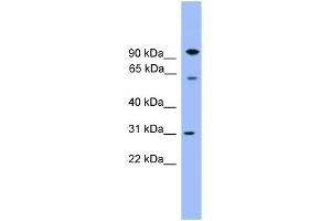 WB Suggested Anti-CPNE6 Antibody Titration: 0. (CPNE6 anticorps  (Middle Region))