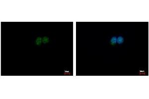 ICC/IF Image ERCC2 antibody [N2C2], Internal detects ERCC2 protein at nucleus by immunofluorescent analysis.