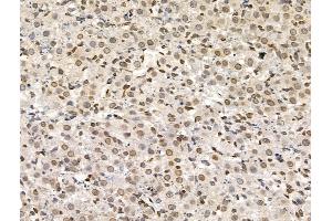 ABIN6258502 and ABIN6274615 at 1/100 staining Rat ovarian tissue by IHC-P.