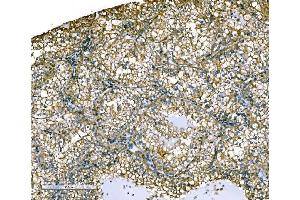 IHC analysis of Ezrin/EZR using anti-Ezrin/EZR antibody (ABIN7603214). (Ezrin anticorps  (N-Term))