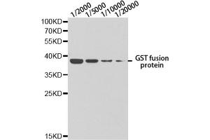 Western blot analysis of GST-tagged protein using GST antibody at different dilution. (GST-Tag anticorps)