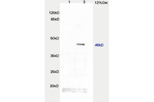 L1 rat brain, L2 human colon carcinoma lysates probed  at 1:200 in 4˚C. (TWIST1, TWIST2 (AA 71-170) anticorps)
