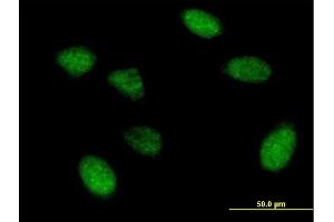Immunofluorescence of purified MaxPab antibody to EIF5A2 on HeLa cell. (EIF5A2 anticorps  (AA 1-153))