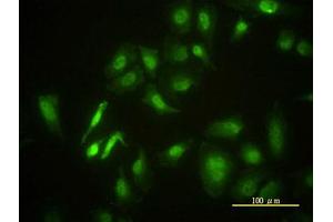 Image no. 4 for anti-serine/threonine Kinase 4 (STK4) (AA 1-40) antibody (ABIN598949) (STK4 anticorps  (AA 1-40))