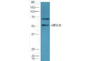 UEVLD anticorps  (AA 85-180)