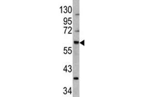 Western blot analysis of MDM2 antibody and 293 lysate (MDM2 anticorps  (AA 141-176))