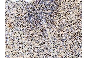 IHC analysis of SDE2 using anti-SDE2 antibody (ABIN7599603). (C1orf55 anticorps  (AA 10-447))