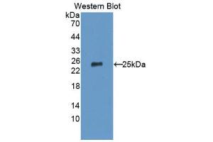 Western Blotting (WB) image for anti-Tumor Necrosis Factor Receptor Superfamily, Member 14 (TNFRSF14) (AA 45-262) antibody (ABIN1176210)