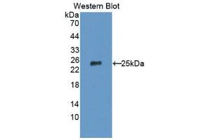 Western Blotting (WB) image for anti-Tumor Necrosis Factor Receptor Superfamily, Member 14 (TNFRSF14) (AA 45-262) antibody (ABIN1176210) (HVEM anticorps  (AA 45-262))