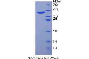 Image no. 1 for Keratin 20 (KRT20) (AA 75-382) protein (His tag) (ABIN6237947)