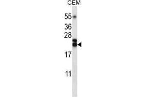 TNFSF4 Antibody (Center) western blot analysis in CEM cell line lysates (35 µg/lane). (TNFSF4 anticorps  (Middle Region))