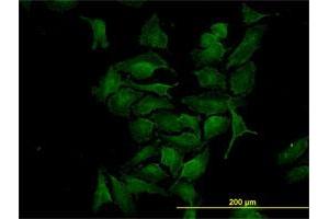 Immunofluorescence of monoclonal antibody to CDK4 on HeLa cell.