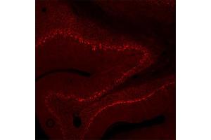 Immunohistochemistry (IHC) image for anti-Solute Carrier Family 6 (Neurotransmitter Transporter, GABA), Member 11 (SLC6A11) (AA 612-627) antibody (ABIN1742537)