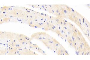 Detection of EPOR in Mouse Cardiac Muscle Tissue using Polyclonal Antibody to Erythropoietin Receptor (EPOR) (EPOR anticorps  (AA 45-244))