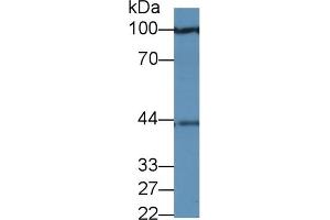 Detection of PRAME in Human 293T cell lysate using Polyclonal Antibody to Preferentially Expressed Antigen In Melanoma (PRAME) (PRAME anticorps  (AA 416-502))