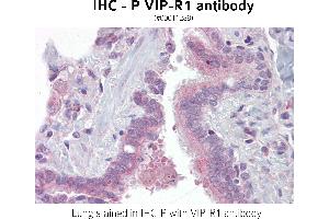 Image no. 1 for anti-Vasoactive Intestinal Peptide Receptor 1 (VIPR1) antibody (ABIN375279) (VIPR1 anticorps)