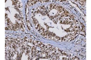 IHC analysis of TIP49A/RUVBL1 using anti-TIP49A/RUVBL1 antibody (ABIN7599928). (RUVBL1 anticorps  (AA 13-23))