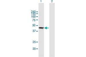 Western Blot analysis of ZCCHC11 expression in transfected 293T cell line by ZCCHC11 MaxPab polyclonal antibody. (ZCCHC11 anticorps  (AA 1-309))