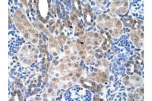 SLC6A18 antibody was used for immunohistochemistry at a concentration of 4-8 ug/ml to stain Epithelial cells of renal tubule (arrows) in Human Kidney. (SLC6A18 anticorps  (Middle Region))