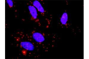 Proximity Ligation Analysis of protein-protein interactions between TGFB2 and BMP2.