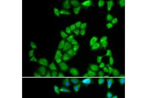 Immunofluorescence analysis of MCF-7 cells using RNASE13 Polyclonal Antibody (RNASE13 anticorps)