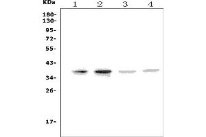 Western blot analysis of MC4R using anti-MC4R antibody (ABIN7602763).