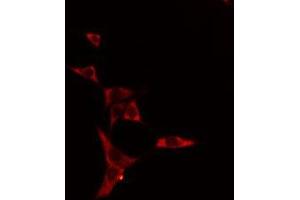 ABIN6275083 staining HeLa cells by IF/ICC. (DNAL1 anticorps  (Internal Region))