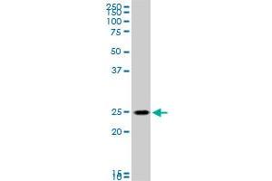 RAB33B monoclonal antibody (M01), clone 6F4.