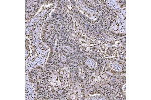 IHC analysis of SNRPA1 using anti-SNRPA1 antibody (ABIN7599131).
