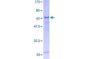 Image no. 1 for Cyclin M3 (CNNM3) (AA 1-355) protein (GST tag) (ABIN1349844)
