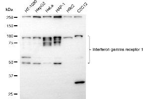 Western blotting analysis using interferon gamma receptor 1 antibody (ABIN7799082). (Recombinant IFNGR1 anticorps)