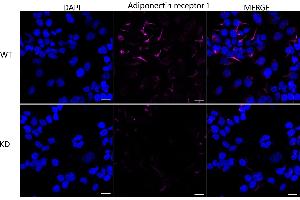 anti-Adiponectin Receptor 1 (ADIPOR1) antibody