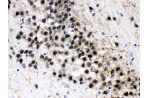 ZWINT was detected in paraffin-embedded sections of rat brain tissues using rabbit anti- ZWINT Antigen Affinity purified polyclonal antibody (Catalog # ) at 1 µg/mL.