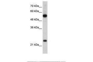 Image no. 1 for anti-Ribosomal Protein L13 (RPL13) (AA 136-185) antibody (ABIN203301) (RPL13 anticorps  (AA 136-185))