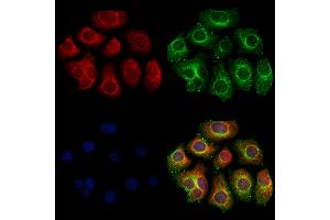 ABIN6260975 and ABIN6273213 staining Hela cells by IF/ICC.