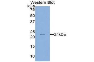 Western Blotting (WB) image for anti-PC4 and SFRS1 Interacting Protein 1 (PSIP1) (AA 311-469) antibody (ABIN1859640) (PSIP1 anticorps  (AA 311-469))