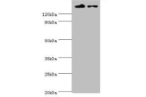 Western blot All lanes: SETDB1 antibody at 5 μg/mL Lane 1: Rat adrenal gland tissue Lane 2: 293T whole cell lysate Secondary Goat polyclonal to rabbit IgG at 1/10000 dilution Predicted band size: 144, 45 kDa Observed band size: 144 kDa (SETDB1 anticorps  (AA 1-397))