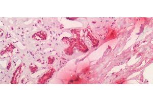 Detection of TPS in Human Breast Tissue using Monoclonal Antibody to Tryptase (TPS)