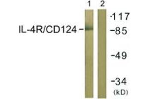 Western blot analysis of extracts from 293 cells, using IL-4R/CD124 (Ab-497) Antibody.