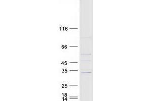 Validation with Western Blot