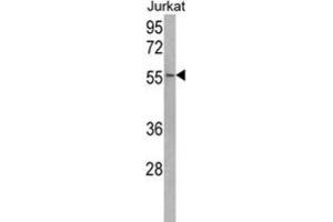 Western Blotting (WB) image for anti-Ubiquitin Specific Peptidase 22 (USP22) antibody (ABIN3001480) (USP22 anticorps)