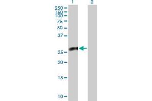 Western Blot analysis of CACYBP expression in transfected 293T cell line by CACYBP MaxPab polyclonal antibody. (CACYBP anticorps  (AA 1-228))